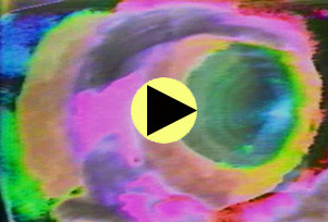The Inner Eye
